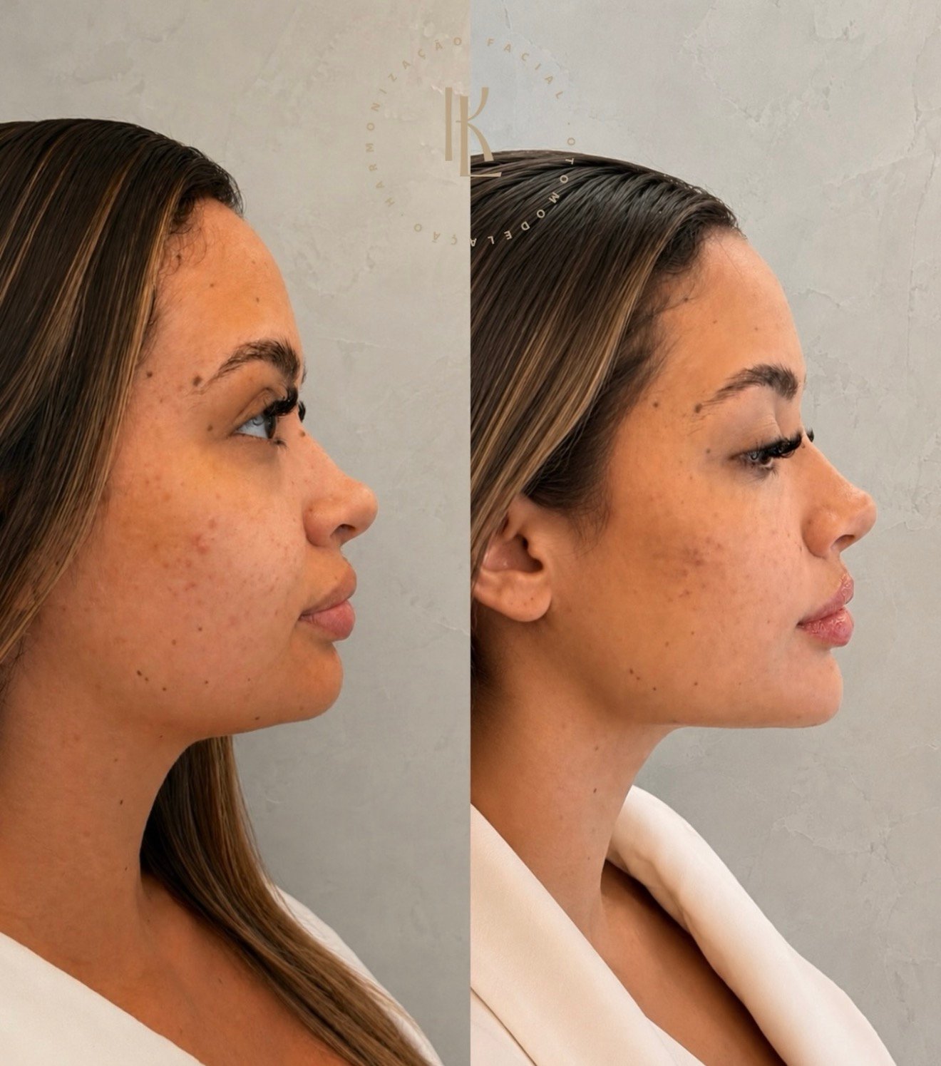 Caso clínico facial